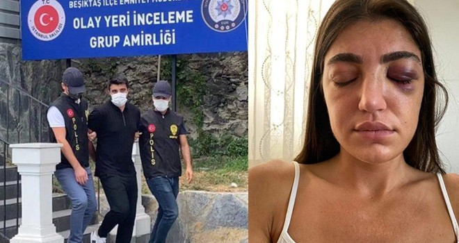 Beşiktaş'ta öldüresiye dövülen mankenin eski sevgilisinden akılalmaz sözler!..