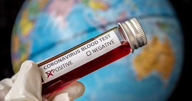 Koronavirüs'de 13 yeni belirti  ortaya çıktı