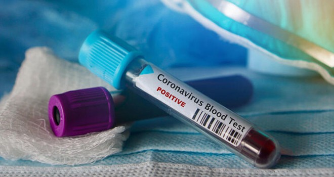 Koronavirüs'de yeni hedef sessiz hastalar
