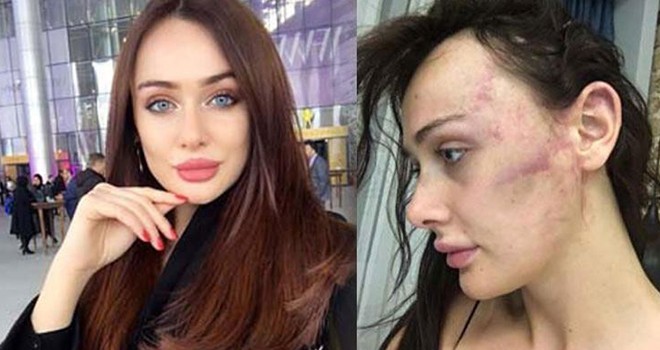 Ortaköy'de Sırp modeli darp edip eve kilitleyen eski sevgili yargı karşısında