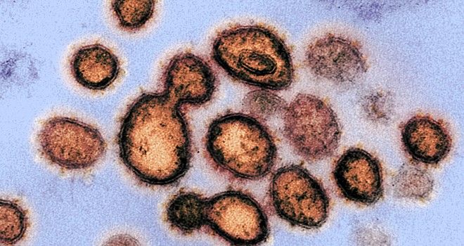 Korkutan açıklama! Mutasyon geçirmiş 40 Koronavirüs bulundu