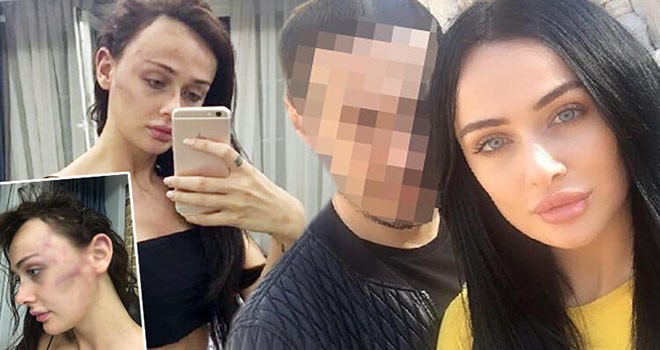 Sevgiliden darp iddiası