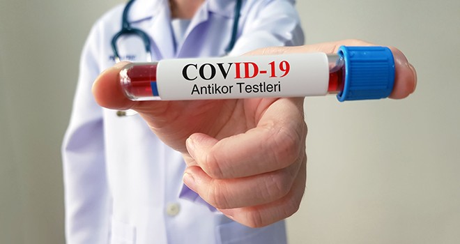 Antikor testlerinin yapılacağı şehirler açıklandı