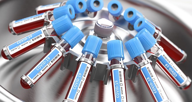 Korona vakası 65 milyonu aştı