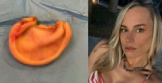 Etiler'de sahipli köpek saldırısı! Soruşturma sürüyor...