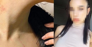 Lüks otelde taciz! Asansöre çekti, odaya sürükledi