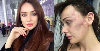 Ortaköy'de Sırp modeli darp edip eve kilitleyen eski sevgili yargı karşısında