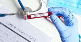 Corona tedavisinde kan sulandırıcılar umut verdi