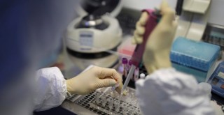 Çin'den giden kitlerde koronavirüs bulundu