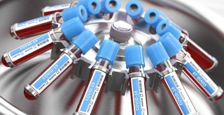 Korona vakası 65 milyonu aştı